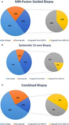 Concordance of MRI-Guided Fusion and Systematic 12-Core Prostate Biopsy for the Detection of Prostate Cancer